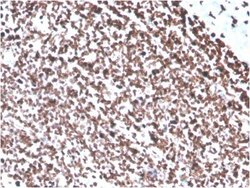 dsDNA Antibody (DSD/4054R) - Azide and BSA Free, Novus Biologicals 100